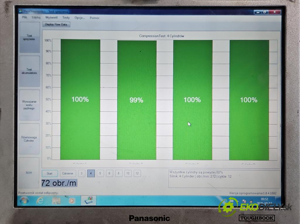 Audi A4 B7 2004-2008 2.0 tdi 140 HP manual 103 kW 1986 cm3 5- motor diesla BRE