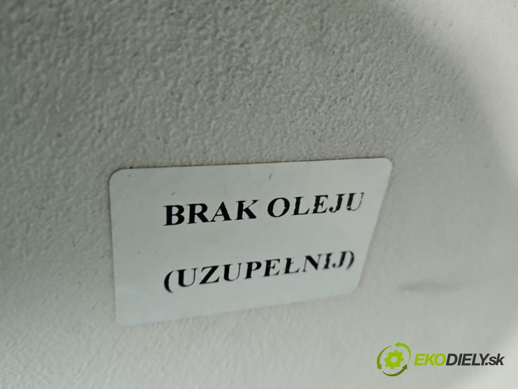 Bmw X1 E84 2009-2015 2.0d 184 hp automatic 135 kW 1995 cm3 5- Redukce: 7643755
